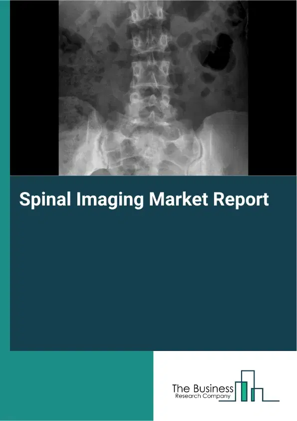 Global Spinal Imaging Market Report 2026