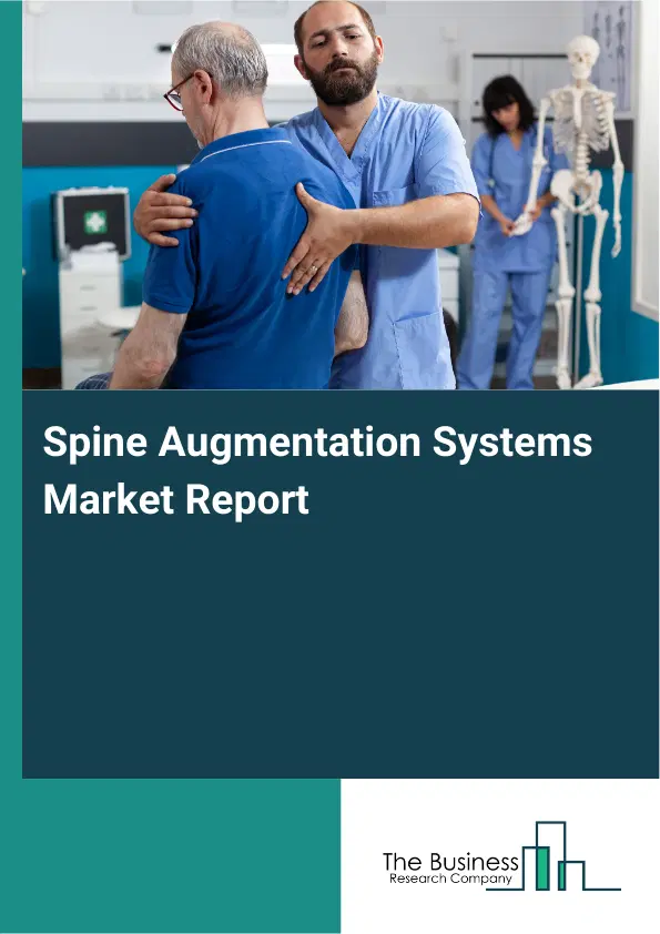 Global Spine Augmentation Systems Market Report 2026
