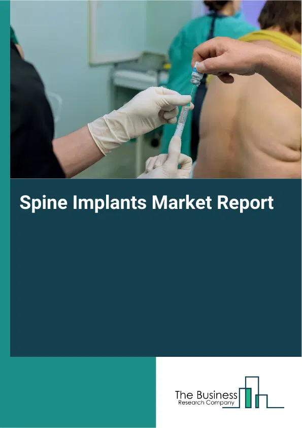 Global Spine Implants Market Report 2026