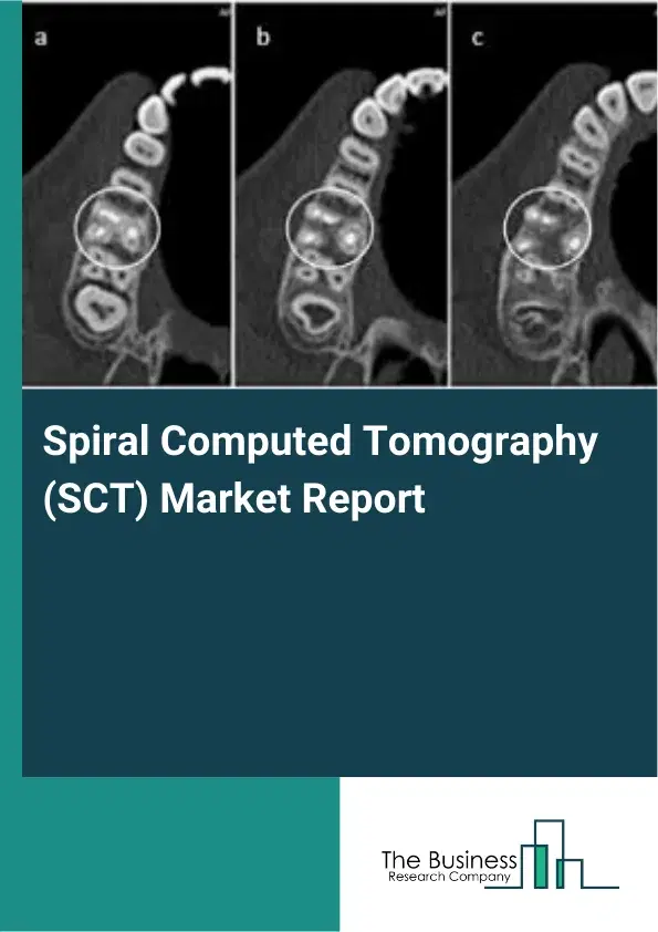 Global Spiral Computed Tomography (SCT) Market Report 2026