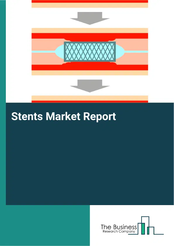 Global Stents Market Report 2026