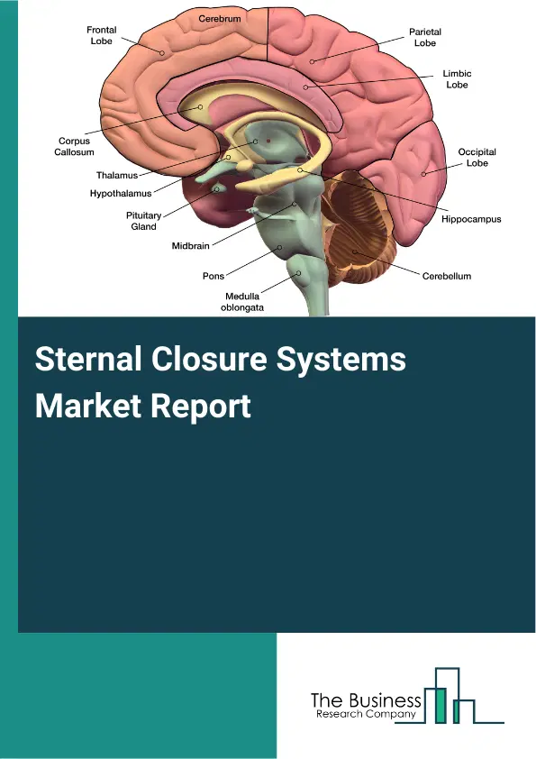 Global Sternal Closure Systems Market Report 2026