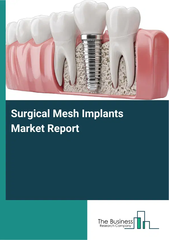 Global Surgical Mesh Implants Market Report 2026
