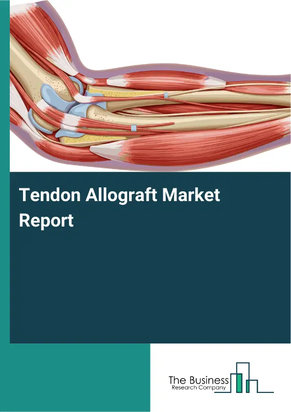 Global Tendon Allograft Market Report 2026