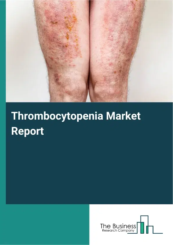 Global Thrombocytopenia Market Report 2026