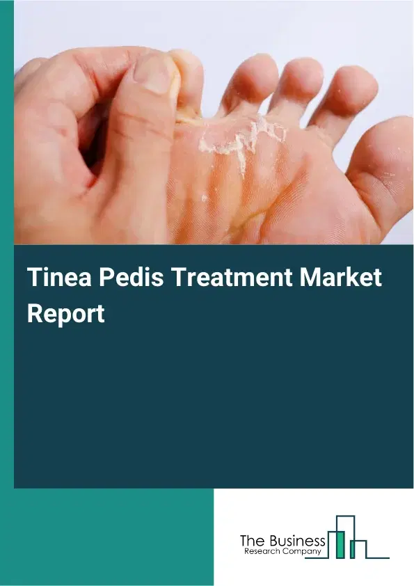 Global Tinea Pedis Treatment Market Report 2026