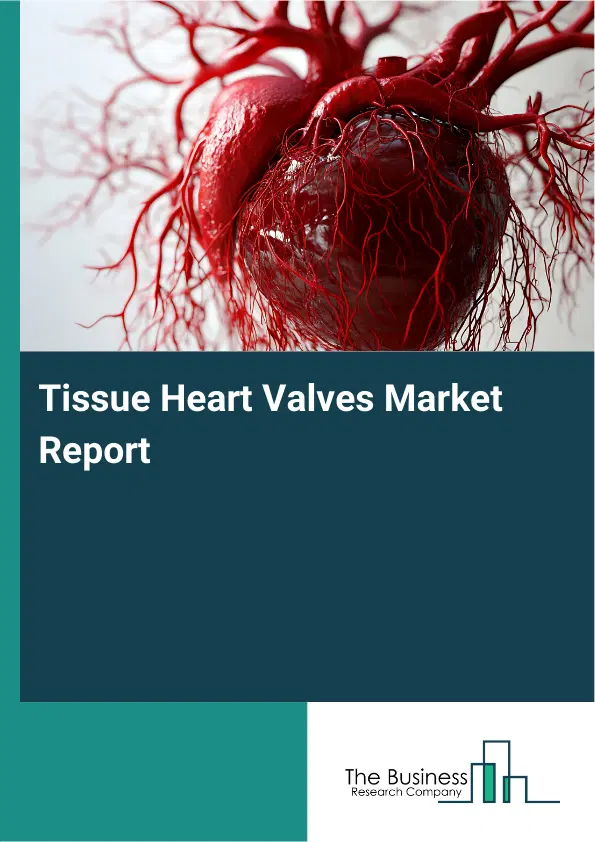 Global Tissue Heart Valves Market Report 2026