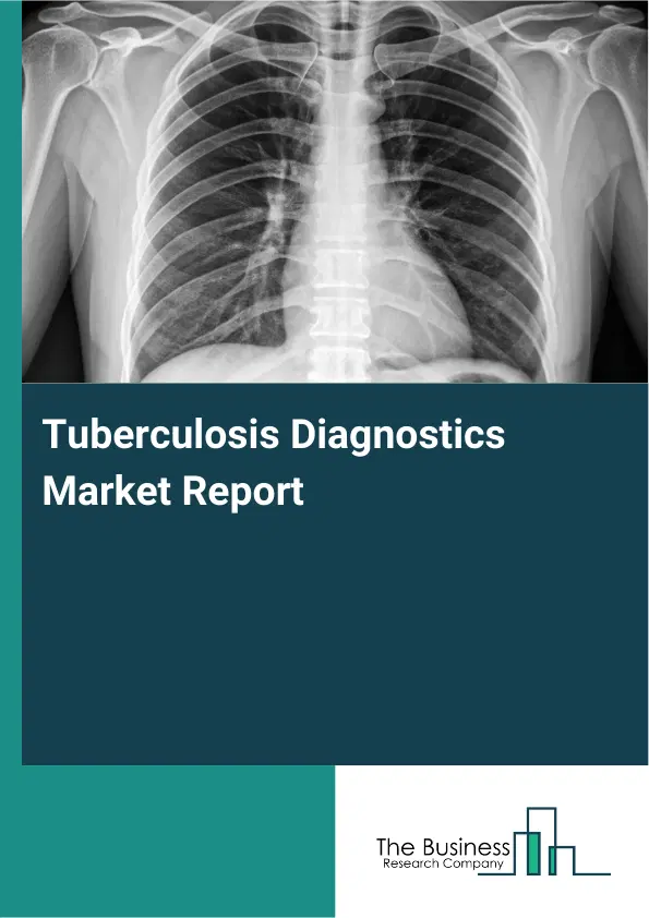 Global Tuberculosis Diagnostics Market Report 2026