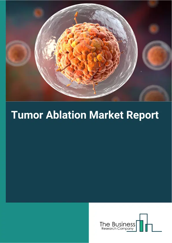 Global Tumor Ablation Market Report 2026