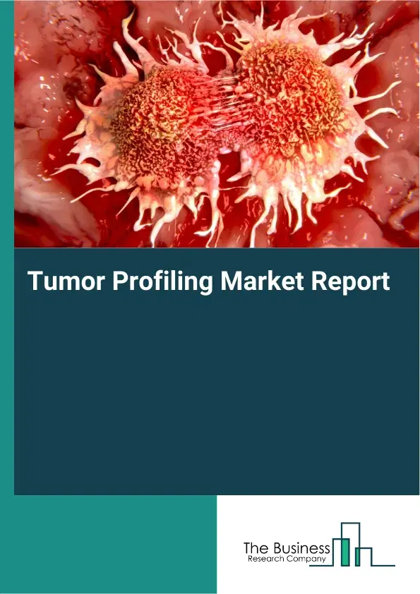 Global Tumor Profiling Market Report 2026