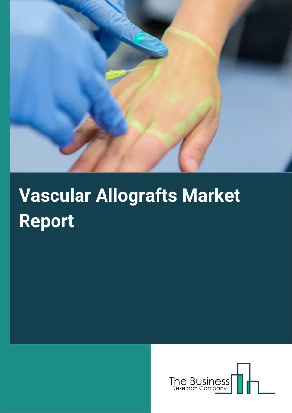 Global Vascular Allografts Market Report 2026