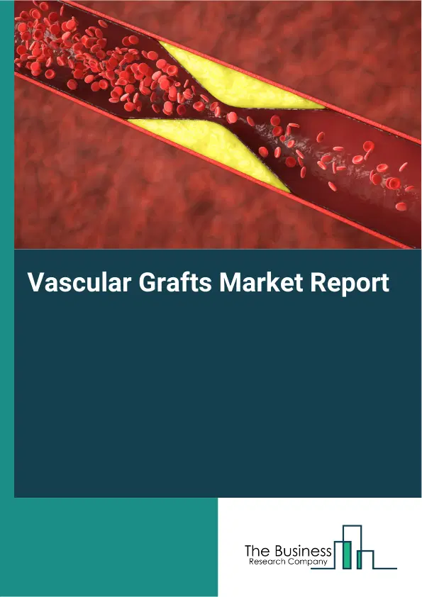 Global Vascular Grafts Market Report 2026