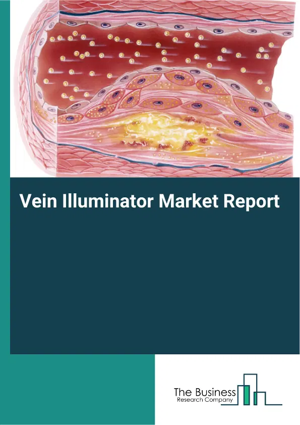 Global Vein Illuminator Market Report 2026