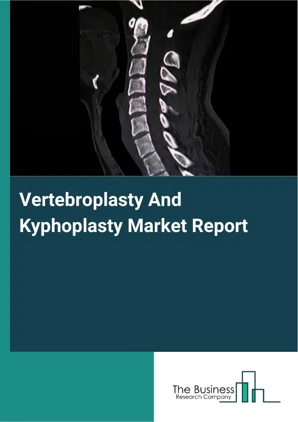 Global Vertebroplasty And Kyphoplasty Market Report 2026