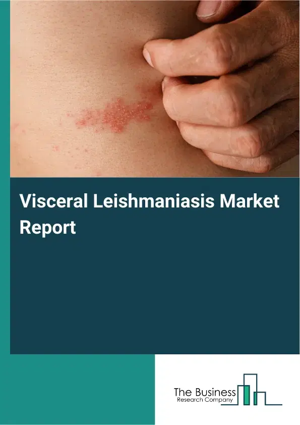 Global Visceral Leishmaniasis Market Report 2026