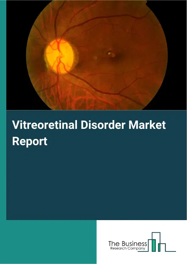 Global Vitreoretinal Disorder Market Report 2026