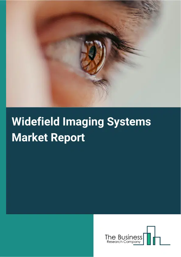Global Widefield Imaging Systems Market Report 2026