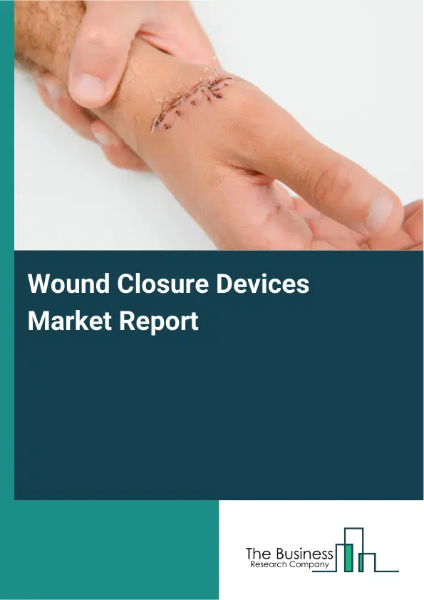 Global Wound Closure Devices Market Report 2026