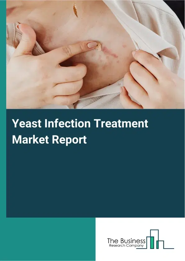 Global Yeast Infection Treatment Market Report 2026