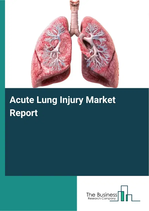 Global Acute Lung Injury Market Report 2026 Global Acute Lung Injury Market Report 2026