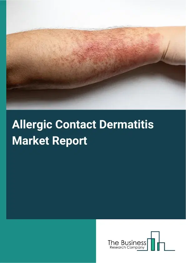 Global Allergic Contact Dermatitis Market Report 2026 Global Allergic Contact Dermatitis Market Report 2026