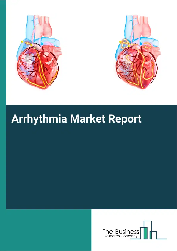 Global Arrhythmia Market Report 2026 Global Arrhythmia Market Report 2026