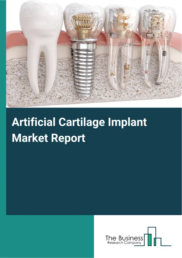 Global Artificial Cartilage Implant Market Report 2026 Global Artificial Cartilage Implant Market Report 2026