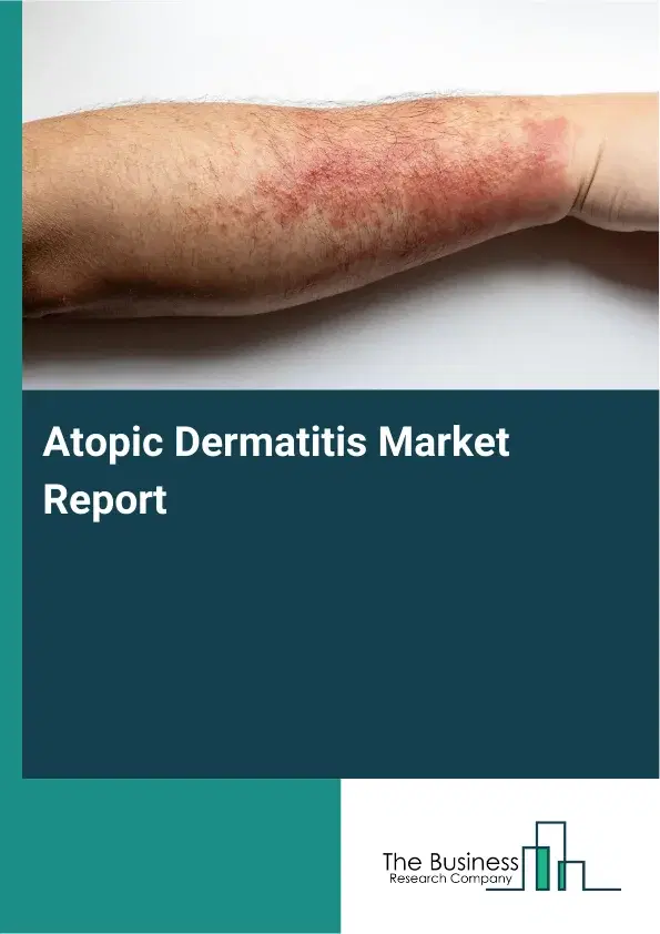Global Atopic Dermatitis Market Report 2026 Global Atopic Dermatitis Market Report 2026