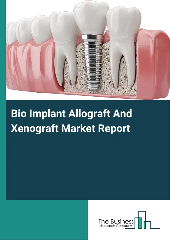 Global Bio Implant Allograft And Xenograft Market Report 2026 Global Bio Implant Allograft And Xenograft Market Report 2026