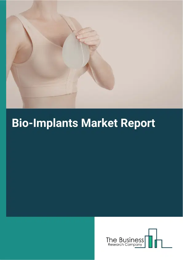 Global Bio-Implants Market Report 2026 Global Bio-Implants Market Report 2026