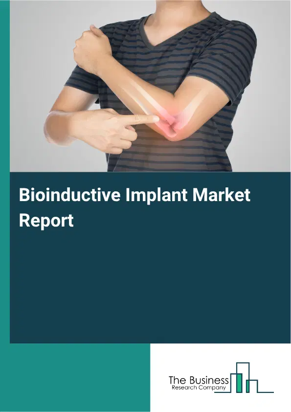 Bioinductive Implant Market Report 2026 Bioinductive Implant Market Report 2026
