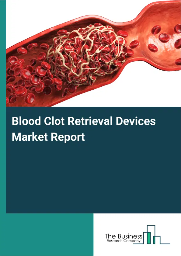 Global Blood Clot Retrieval Devices Market Report 2026 Global Blood Clot Retrieval Devices Market Report 2026