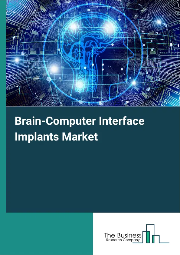 Brain-Computer Interface Implants Market Report 2026 Brain-Computer Interface Implants Market Report 2026