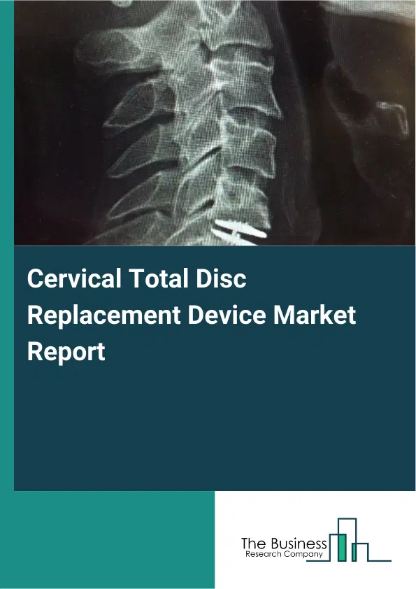 Global Cervical Total Disc Replacement Device Market Report 2026 Global Cervical Total Disc Replacement Device Market Report 2026
