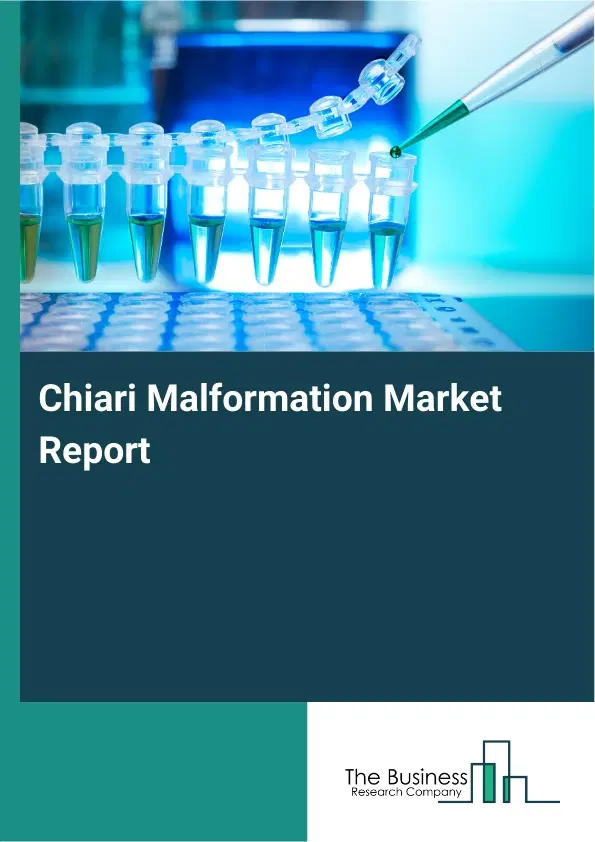 Global Chiari Malformation Market Report 2026 Global Chiari Malformation Market Report 2026