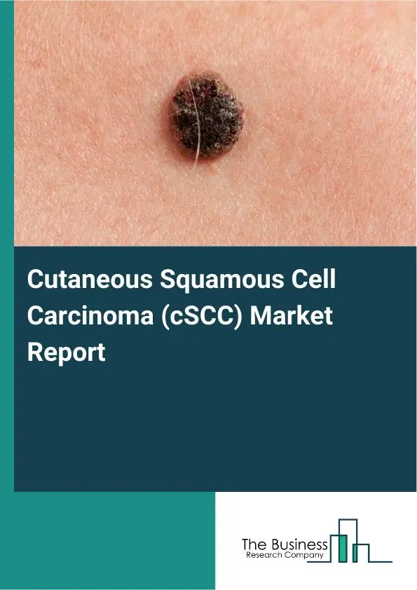 Global Cutaneous Squamous Cell Carcinoma (cSCC) Market Report 2026 Global Cutaneous Squamous Cell Carcinoma (cSCC) Market Report 2026