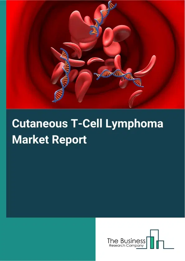 Global Cutaneous T-Cell Lymphoma Market Report 2026 Global Cutaneous T-Cell Lymphoma Market Report 2026