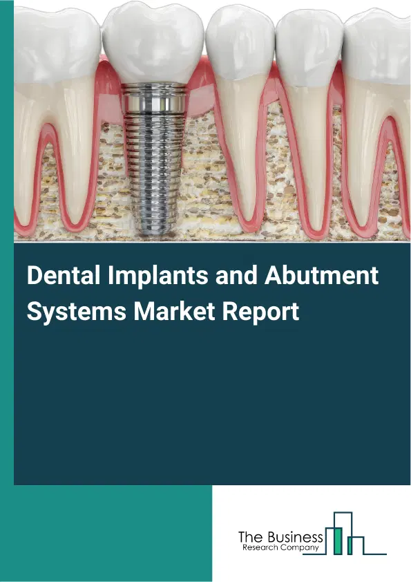 Global Dental Implants and Abutment Systems Market Report 2026 Global Dental Implants and Abutment Systems Market Report 2026