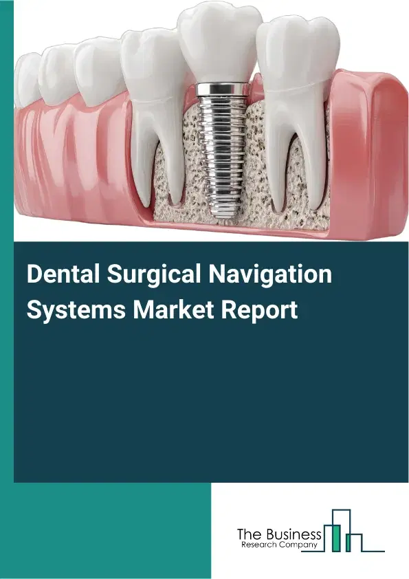 Global Dental Surgical Navigation Systems Market Report 2026 Global Dental Surgical Navigation Systems Market Report 2026