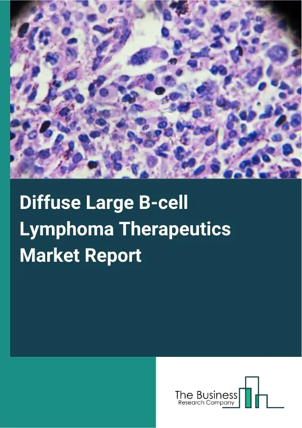 Global Diffuse Large B-cell Lymphoma Therapeutics Market Report 2026 Global Diffuse Large B-cell Lymphoma Therapeutics Market Report 2026