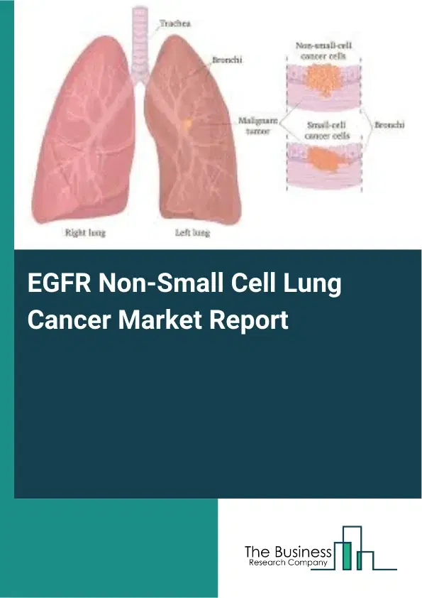 Global EGFR Non-Small Cell Lung Cancer Market Report 2026 Global EGFR Non-Small Cell Lung Cancer Market Report 2026