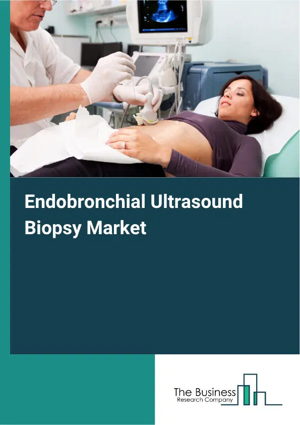 Endobronchial Ultrasound Biopsy Market Report 2026 Endobronchial Ultrasound Biopsy Market Report 2026