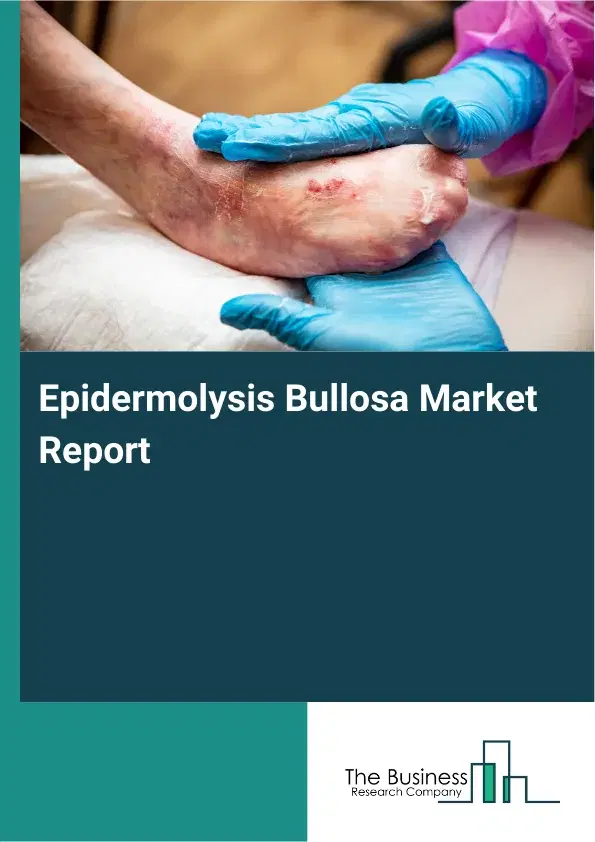 Global Epidermolysis Bullosa Market Report 2026 Global Epidermolysis Bullosa Market Report 2026