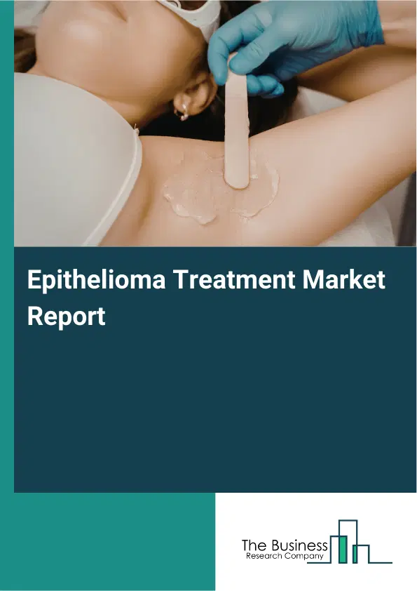 Global Epithelioma Treatment Market Report 2026 Global Epithelioma Treatment Market Report 2026