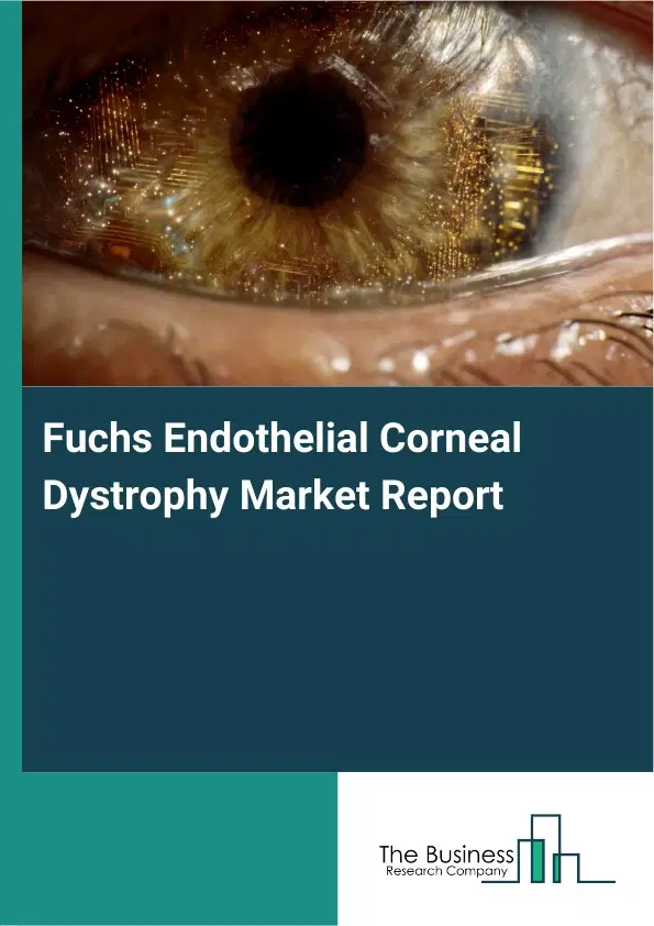 Global Fuchs Endothelial Corneal Dystrophy Market Report 2026 Global Fuchs Endothelial Corneal Dystrophy Market Report 2026