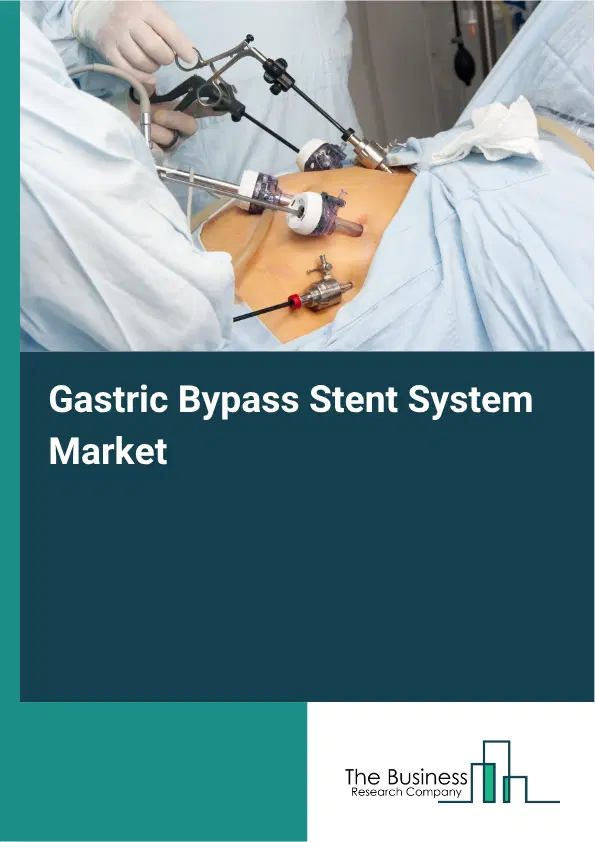 Gastric Bypass Stent System Market Report 2026 Gastric Bypass Stent System Market Report 2026