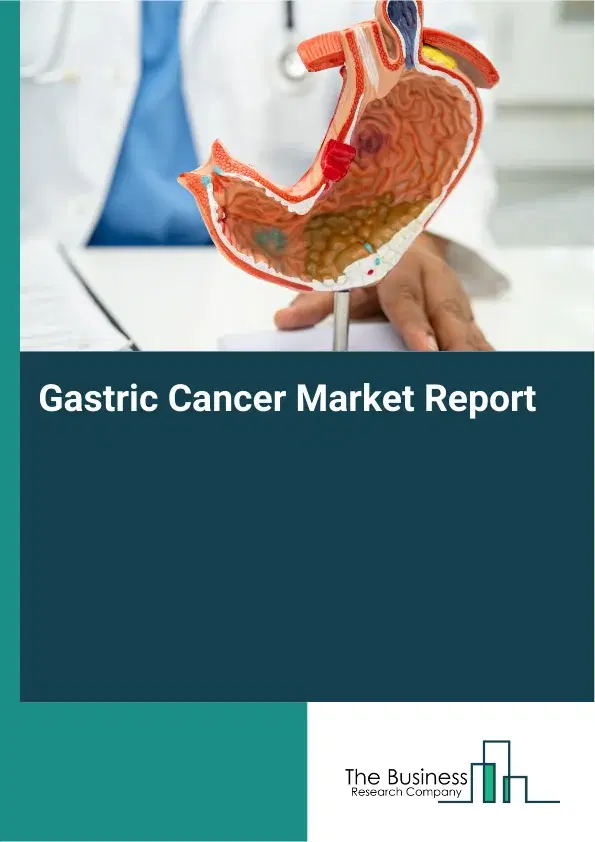 Global Gastric Cancer Market Report 2026 Global Gastric Cancer Market Report 2026