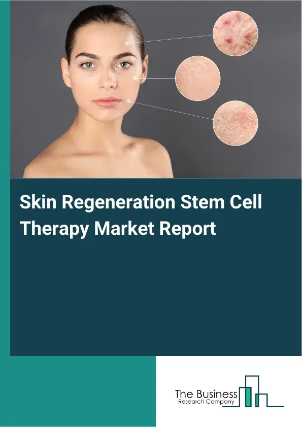 Global Skin Regeneration Stem Cell Therapy Market Report 2026 Global Skin Regeneration Stem Cell Therapy Market Report 2026