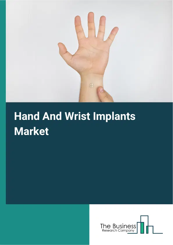 Hand And Wrist Implants Market Report 2026 Hand And Wrist Implants Market Report 2026