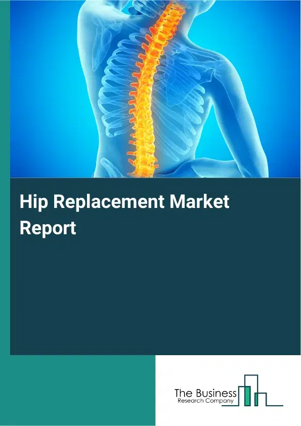 Global Hip Replacement Market Report 2026 Global Hip Replacement Market Report 2026